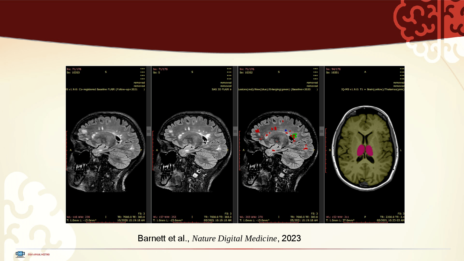 Slide 16: Barnett et al., Nature Digital Medicine, 2023