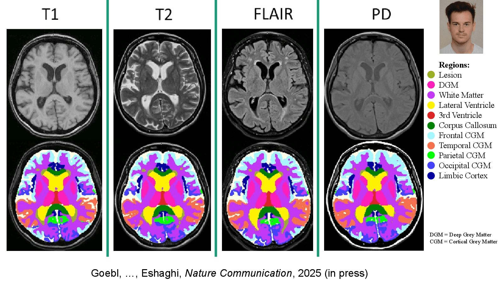 Slide 8: Goebl, …, Eshaghi, Nature Communication, 2025 (in press)