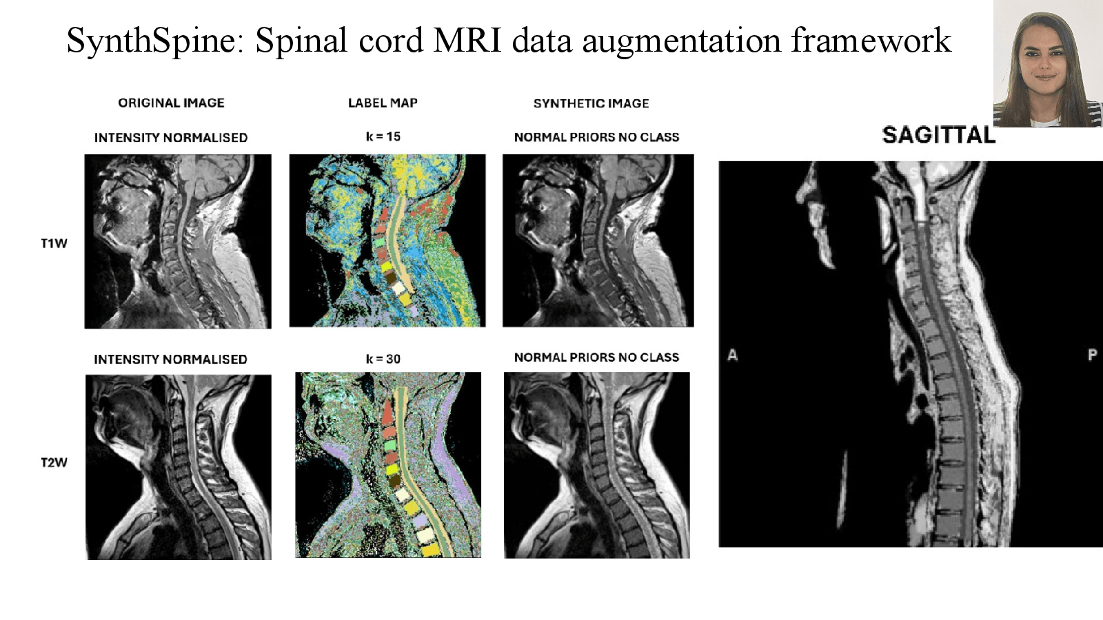 Slide 11: SynthSpine: Spinal cord MRI data augmentation framework