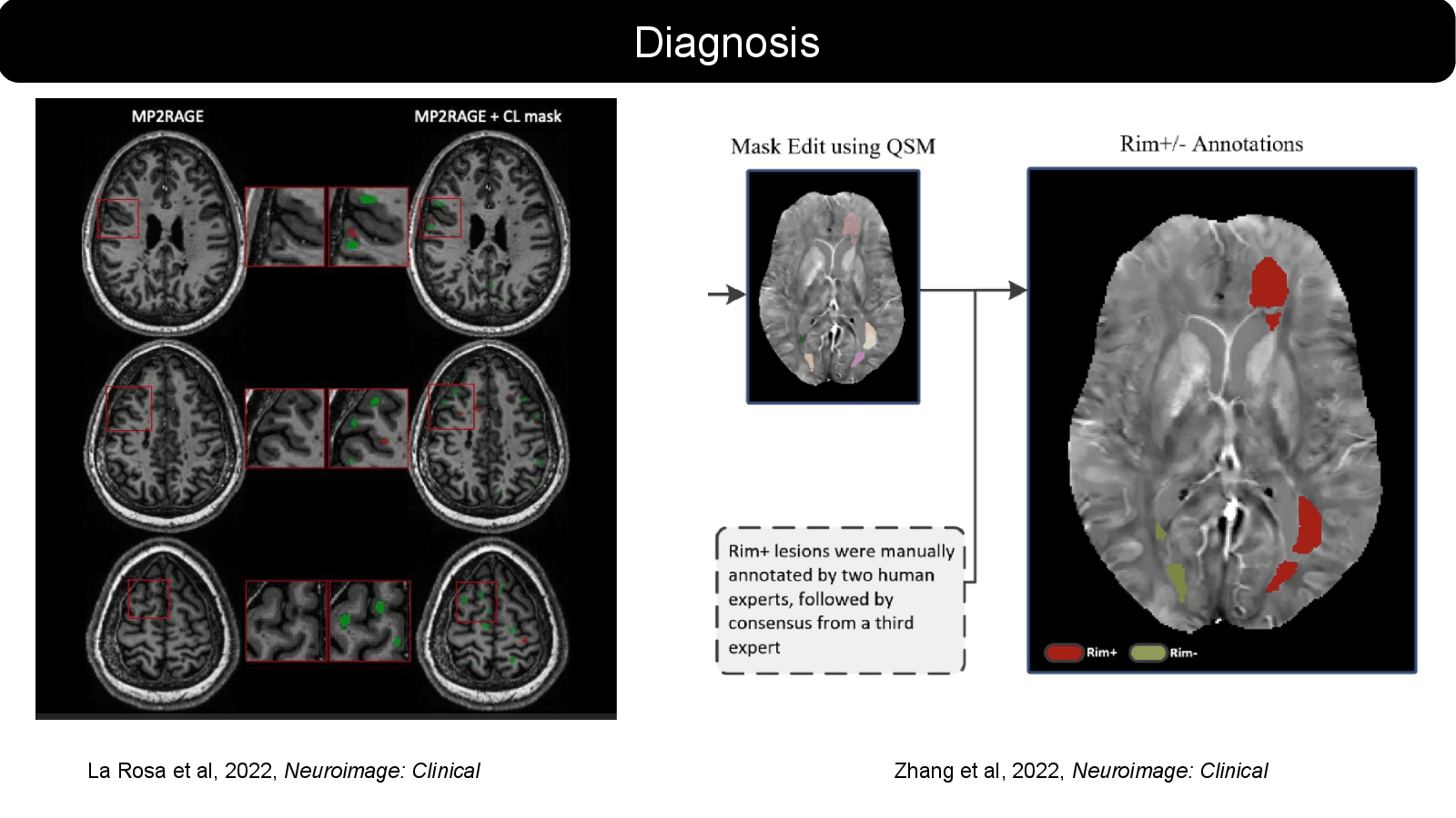 Slide 9: La Rosa et al, 2022, Neuroimage: Clinical