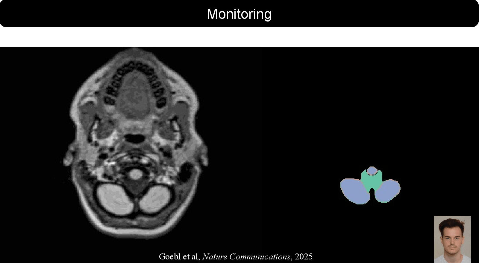 Slide 10: Goebl et al, Nature Communications, 2025