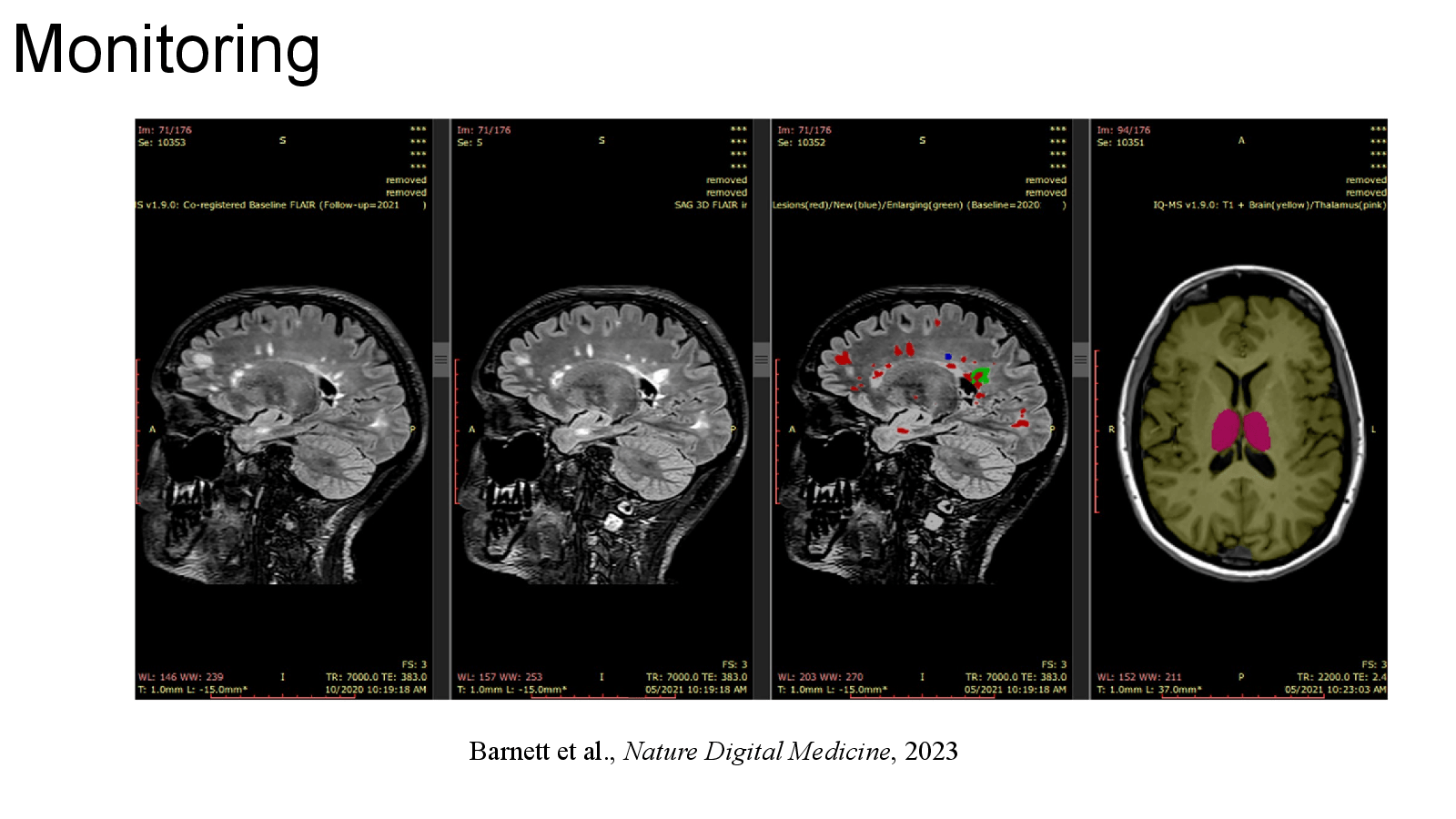 Slide 10: Barnett et al., Nature Digital Medicine, 2023
