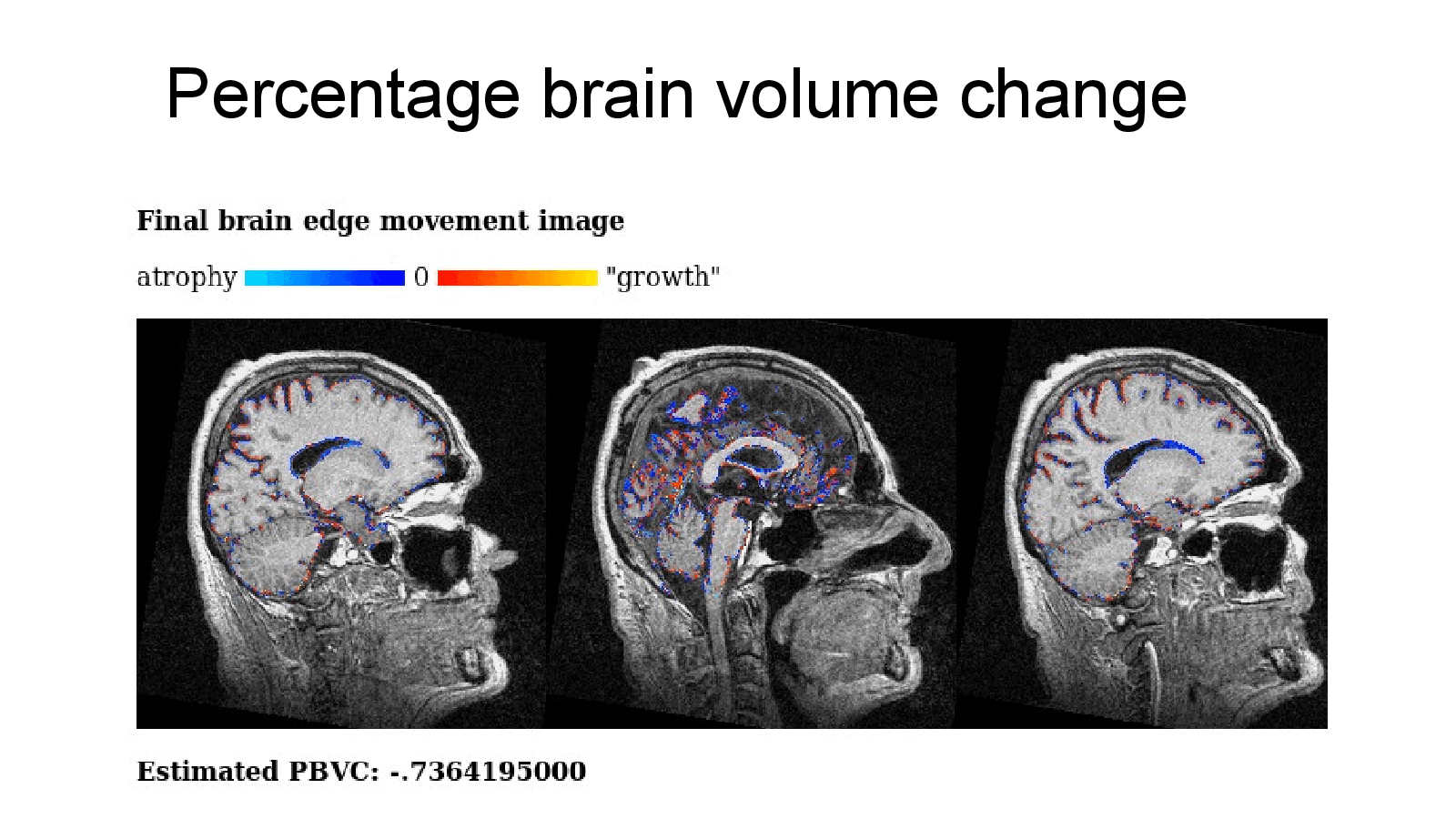 Slide 14: Percentage brain volume change