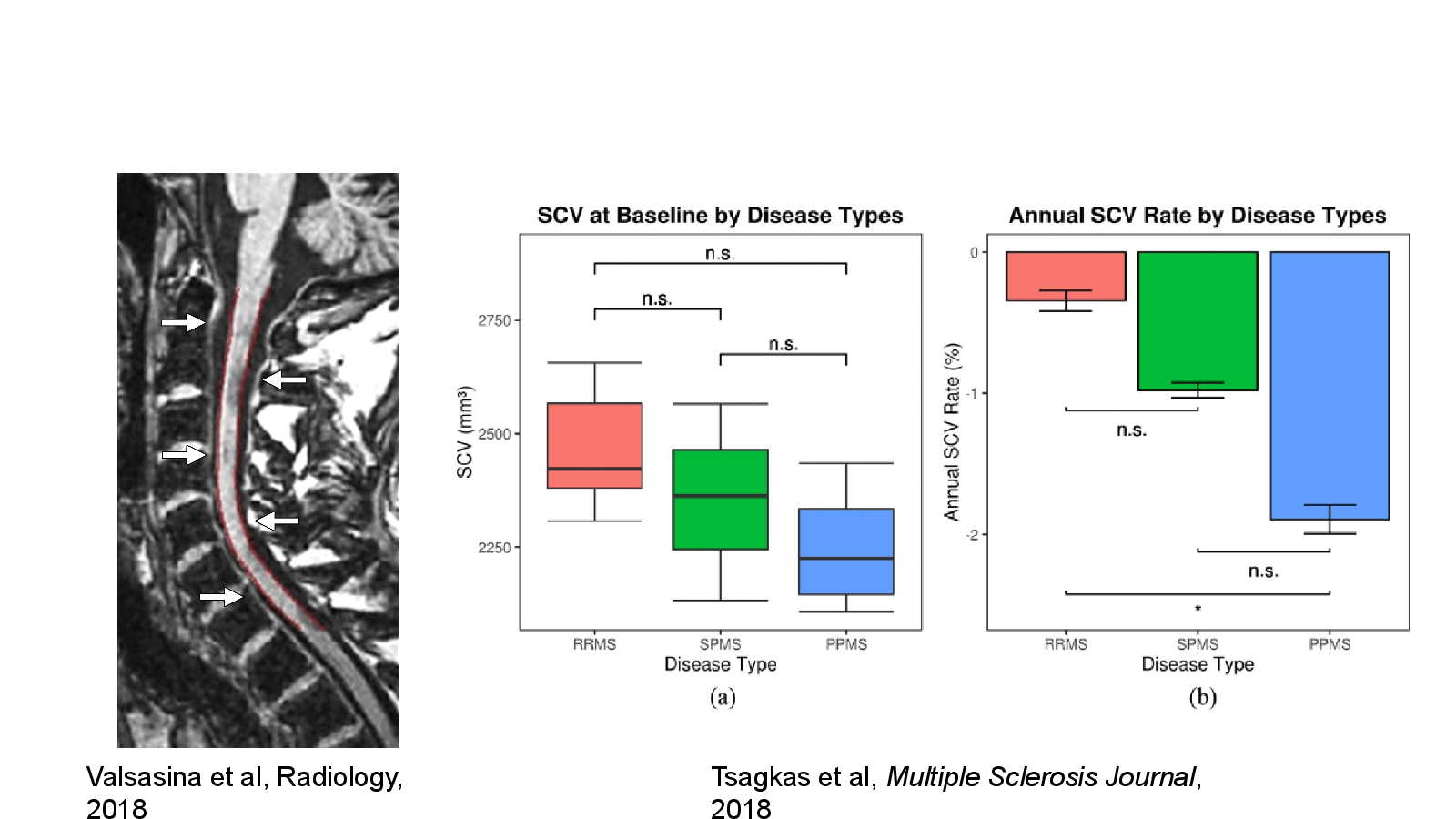 Slide 28: Tsagkas et al, Multiple Sclerosis Journal, 2018
