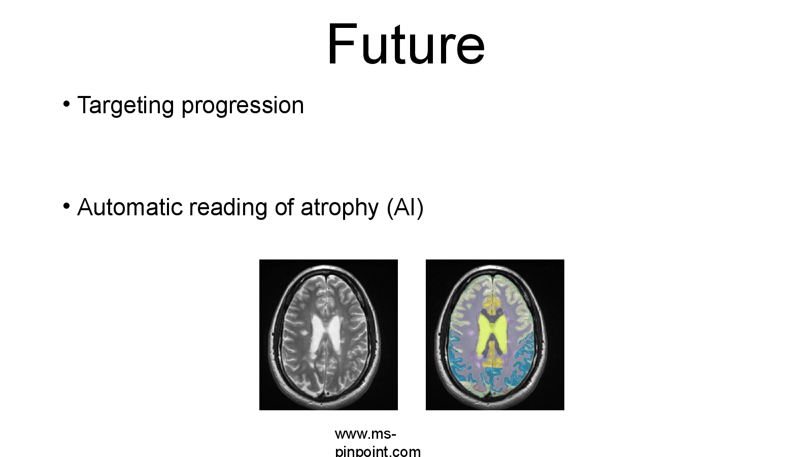 Slide 32: Future
